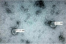 Vietnam succeeds in isolating novel coronavirus